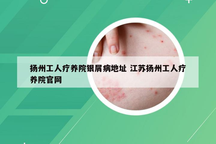 扬州工人疗养院银屑病地址 江苏扬州工人疗养院官网