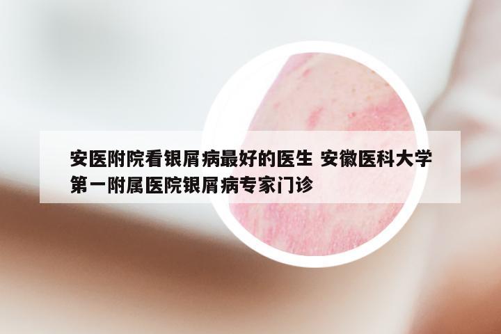 安医附院看银屑病最好的医生 安徽医科大学第一附属医院银屑病专家门诊