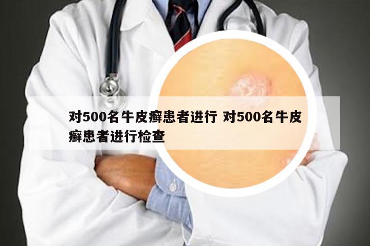对500名牛皮癣患者进行 对500名牛皮癣患者进行检查