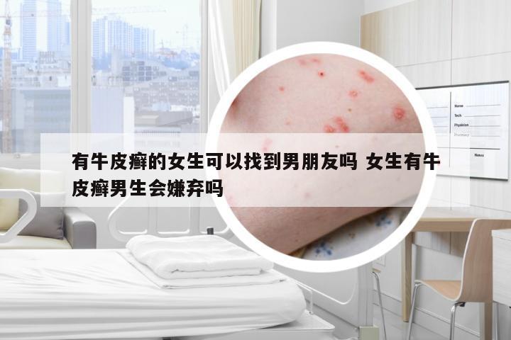 有牛皮癣的女生可以找到男朋友吗 女生有牛皮癣男生会嫌弃吗