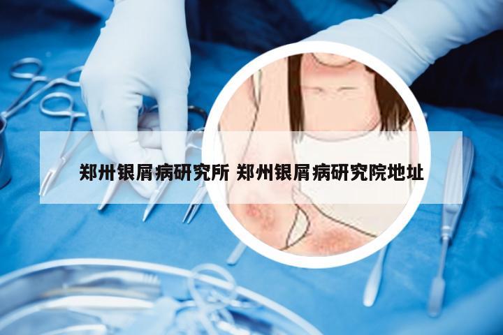 郑卅银屑病研究所 郑州银屑病研究院地址