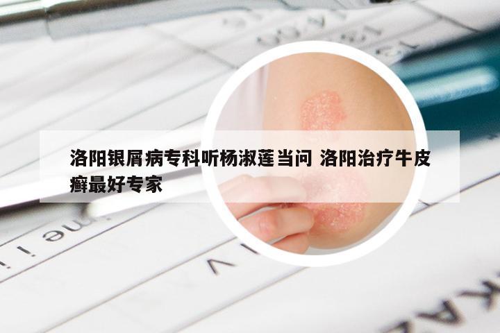 洛阳银屑病专科听杨淑莲当问 洛阳治疗牛皮癣最好专家