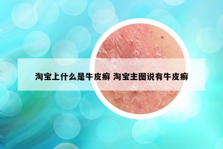 淘宝上什么是牛皮癣 淘宝主图说有牛皮癣