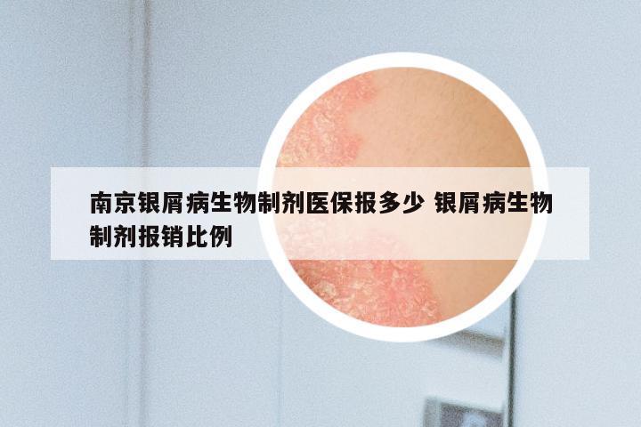 南京银屑病生物制剂医保报多少 银屑病生物制剂报销比例