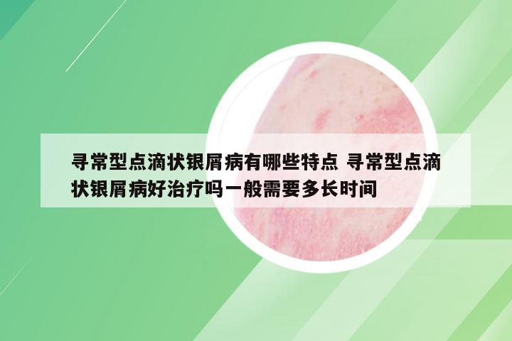 寻常型点滴状银屑病有哪些特点 寻常型点滴状银屑病好治疗吗一般需要多长时间