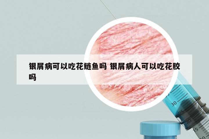 银屑病可以吃花鲢鱼吗 银屑病人可以吃花胶吗