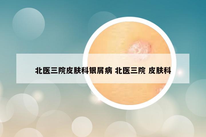 北医三院皮肤科银屑病 北医三院 皮肤科