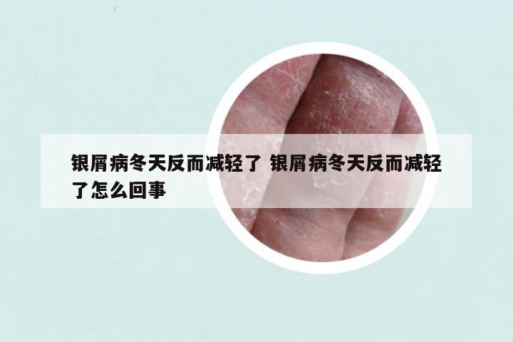 银屑病冬天反而减轻了 银屑病冬天反而减轻了怎么回事