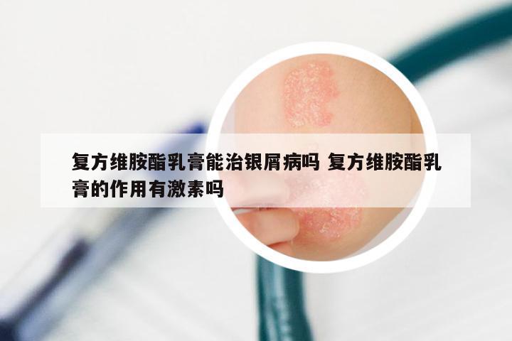 复方维胺酯乳膏能治银屑病吗 复方维胺酯乳膏的作用有激素吗
