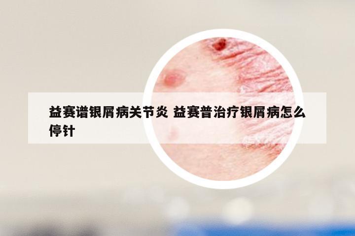 益赛谱银屑病关节炎 益赛普治疗银屑病怎么停针
