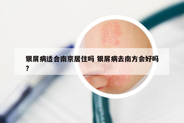 银屑病适合南京居住吗 银屑病去南方会好吗?