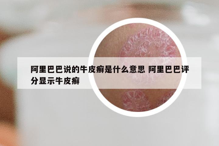 阿里巴巴说的牛皮癣是什么意思 阿里巴巴评分显示牛皮癣