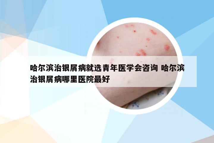 哈尔滨治银屑病就选青年医学会咨询 哈尔滨治银屑病哪里医院最好