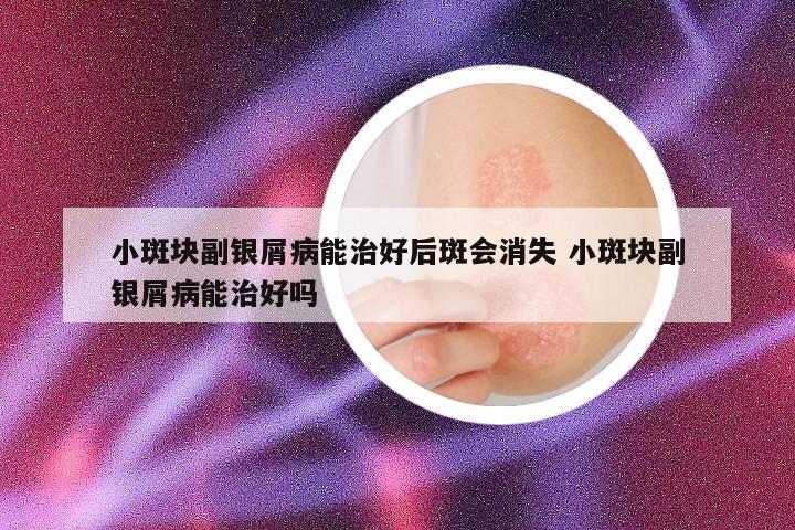 小斑块副银屑病能治好后斑会消失 小斑块副银屑病能治好吗