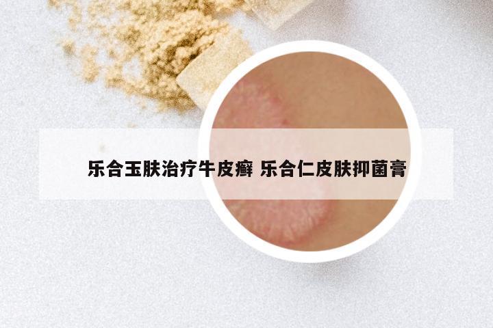 乐合玉肤治疗牛皮癣 乐合仁皮肤抑菌膏