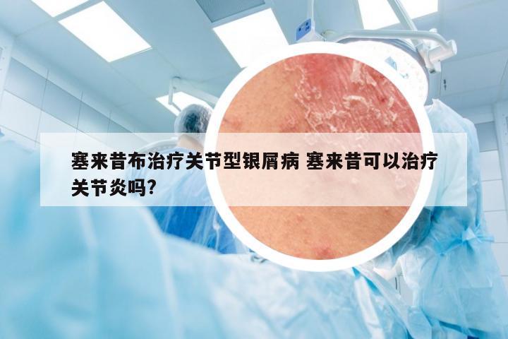 塞来昔布治疗关节型银屑病 塞来昔可以治疗关节炎吗?