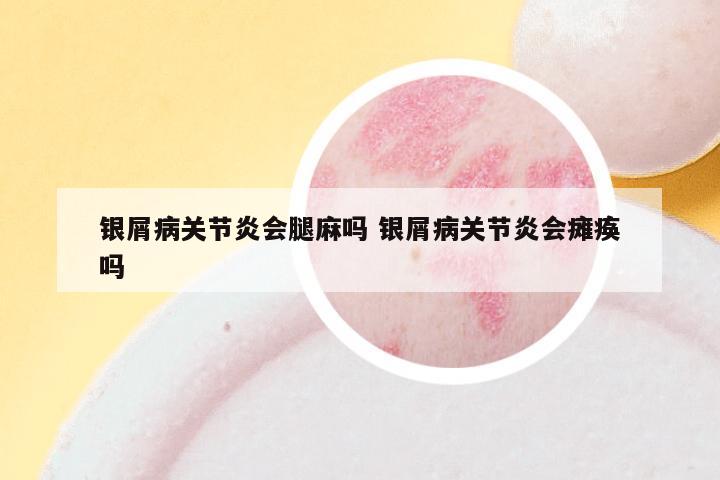 银屑病关节炎会腿麻吗 银屑病关节炎会瘫痪吗
