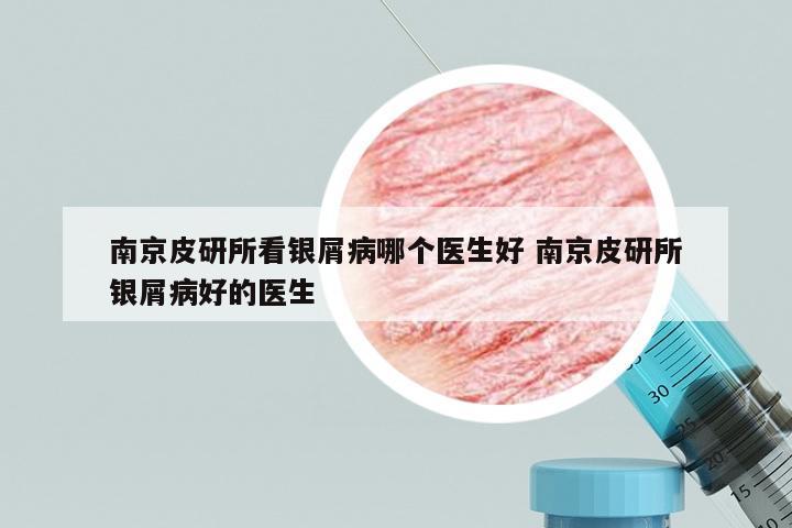 南京皮研所看银屑病哪个医生好 南京皮研所银屑病好的医生