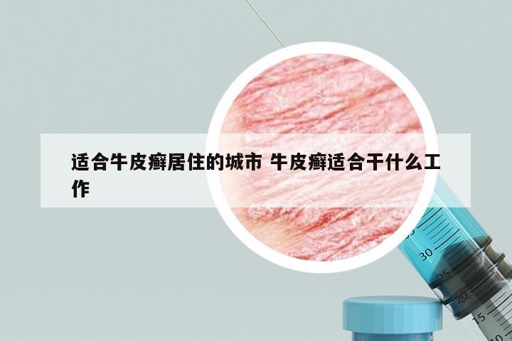 适合牛皮癣居住的城市 牛皮癣适合干什么工作