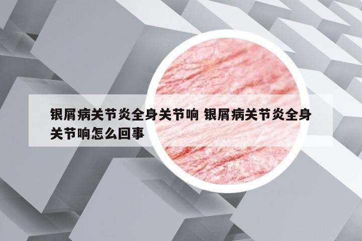 银屑病关节炎全身关节响 银屑病关节炎全身关节响怎么回事