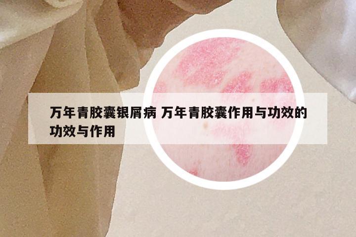 万年青胶囊银屑病 万年青胶囊作用与功效的功效与作用