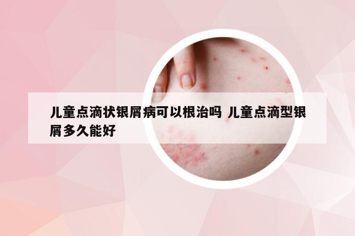 儿童点滴状银屑病可以根治吗 儿童点滴型银屑多久能好