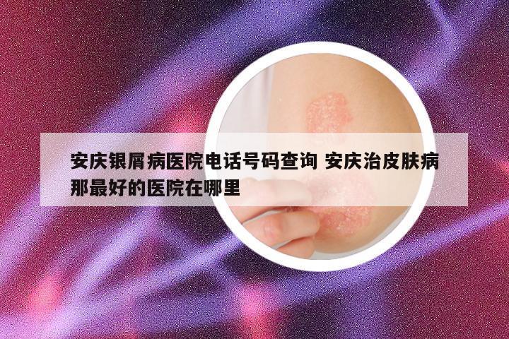 安庆银屑病医院电话号码查询 安庆治皮肤病那最好的医院在哪里