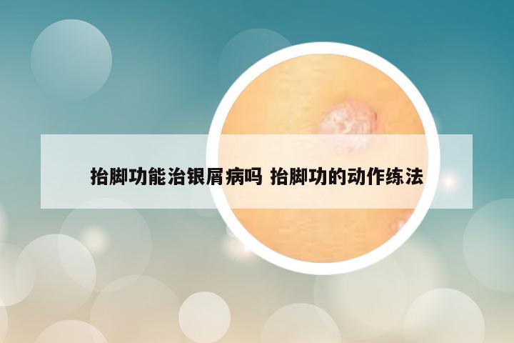 抬脚功能治银屑病吗 抬脚功的动作练法