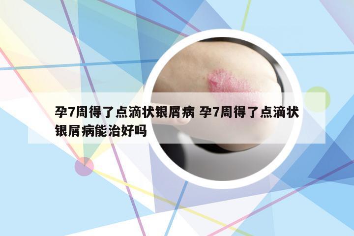 孕7周得了点滴状银屑病 孕7周得了点滴状银屑病能治好吗