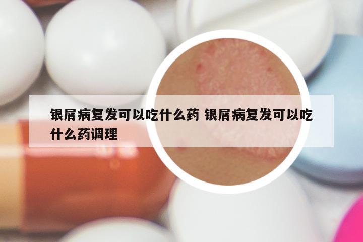 银屑病复发可以吃什么药 银屑病复发可以吃什么药调理