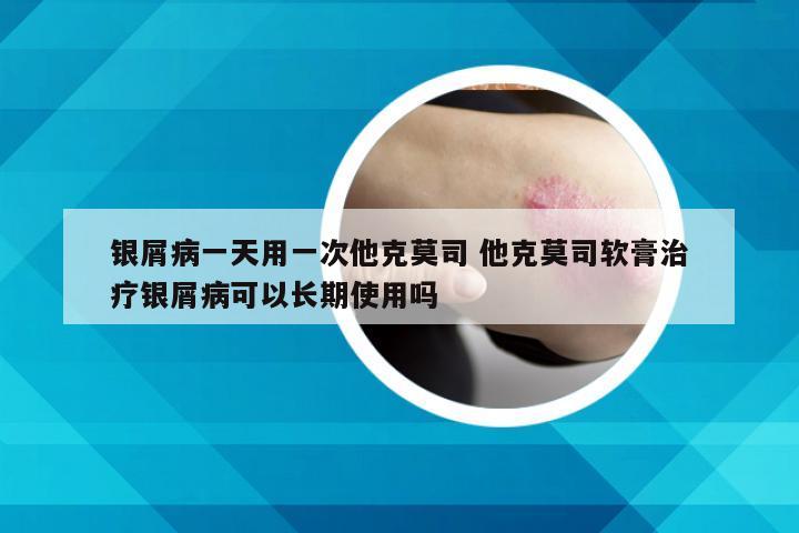 银屑病一天用一次他克莫司 他克莫司软膏治疗银屑病可以长期使用吗