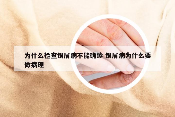 为什么检查银屑病不能确诊 银屑病为什么要做病理