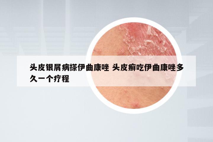 头皮银屑病搽伊曲康唑 头皮癣吃伊曲康唑多久一个疗程