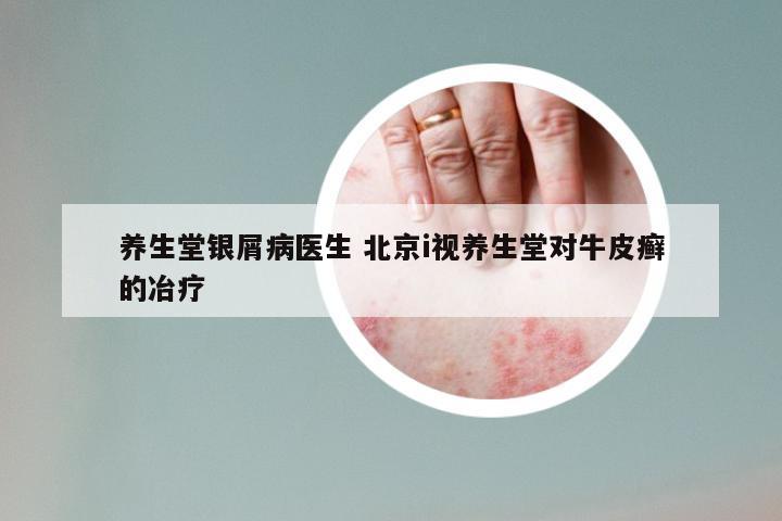 养生堂银屑病医生 北京i视养生堂对牛皮癣的冶疗