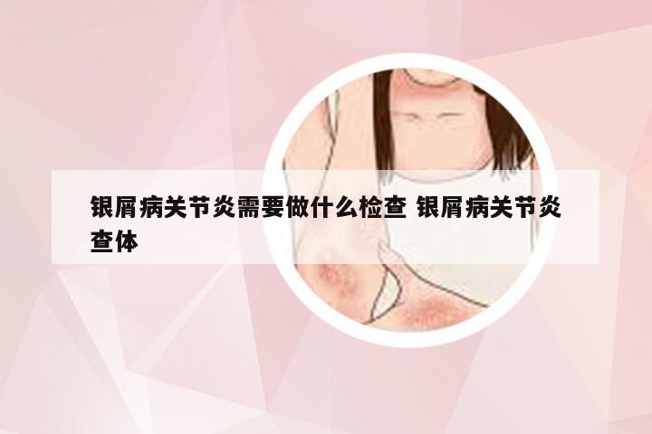 银屑病关节炎需要做什么检查 银屑病关节炎查体