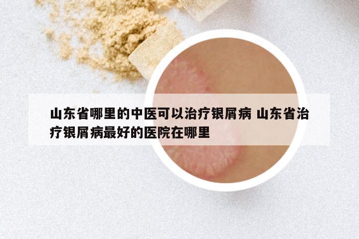 山东省哪里的中医可以治疗银屑病 山东省治疗银屑病最好的医院在哪里