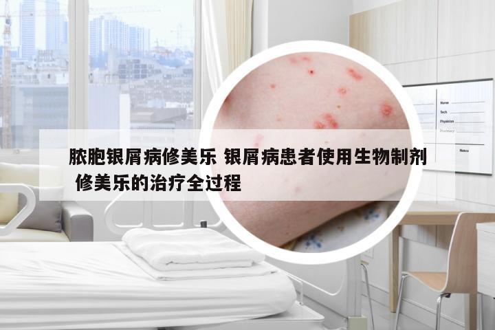 脓胞银屑病修美乐 银屑病患者使用生物制剂 修美乐的治疗全过程