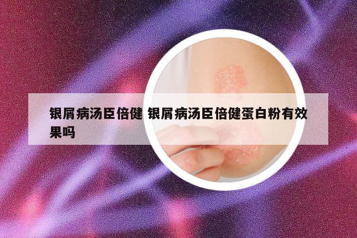 银屑病汤臣倍健 银屑病汤臣倍健蛋白粉有效果吗