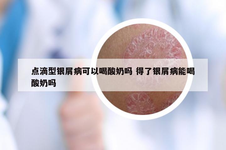 点滴型银屑病可以喝酸奶吗 得了银屑病能喝酸奶吗