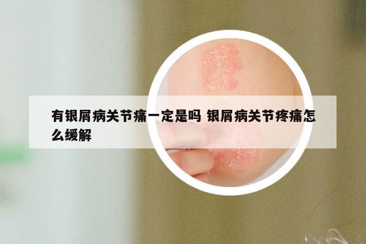 有银屑病关节痛一定是吗 银屑病关节疼痛怎么缓解