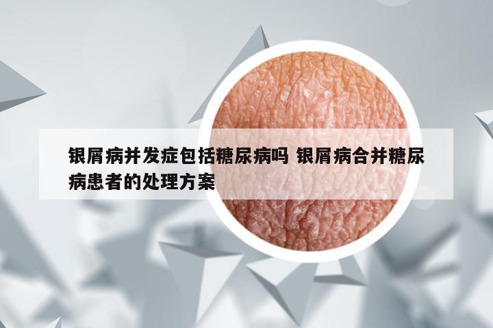 银屑病并发症包括糖尿病吗 银屑病合并糖尿病患者的处理方案