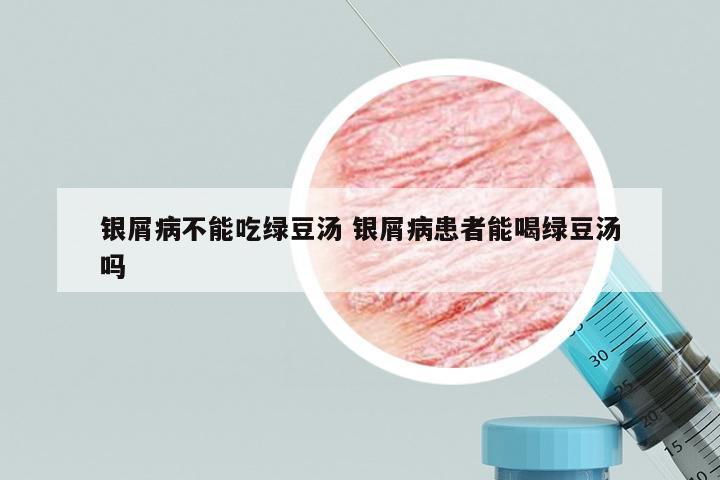 银屑病不能吃绿豆汤 银屑病患者能喝绿豆汤吗