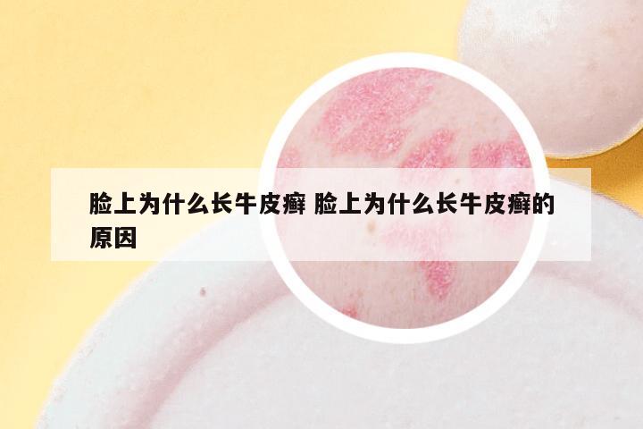 脸上为什么长牛皮癣 脸上为什么长牛皮癣的原因