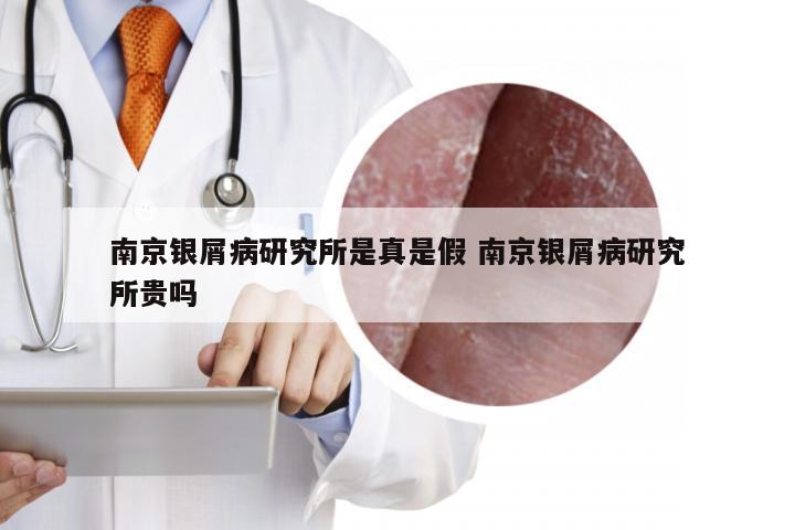 南京银屑病研究所是真是假 南京银屑病研究所贵吗