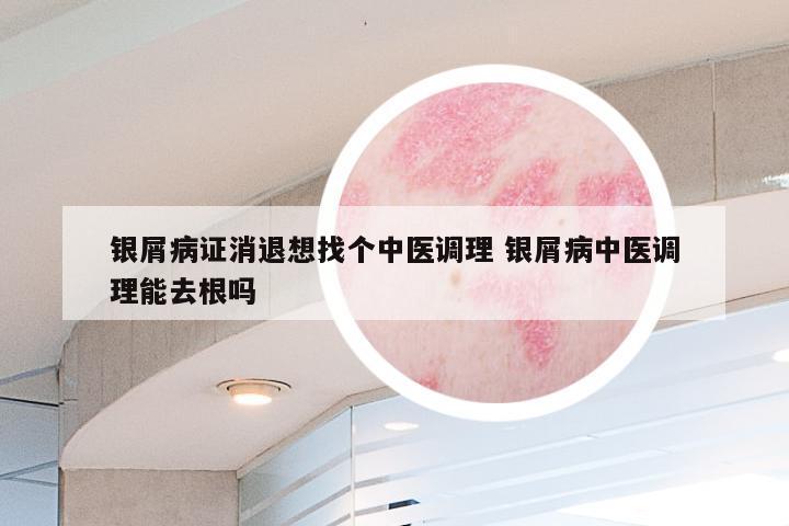银屑病证消退想找个中医调理 银屑病中医调理能去根吗