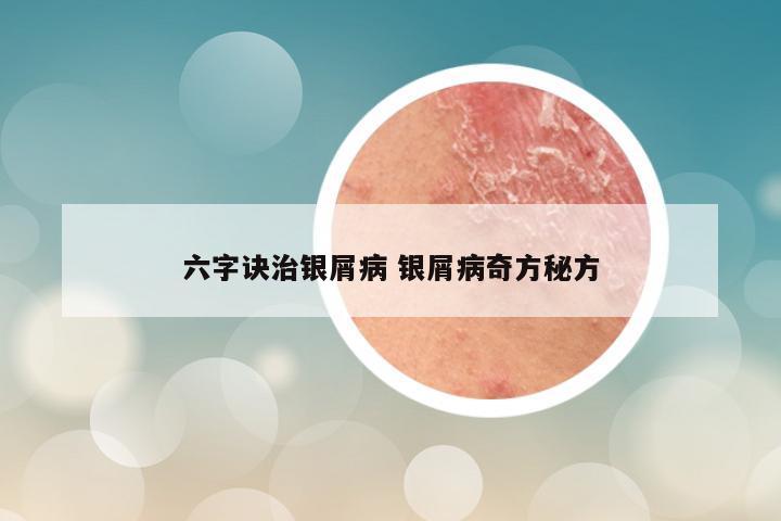 六字诀治银屑病 银屑病奇方秘方