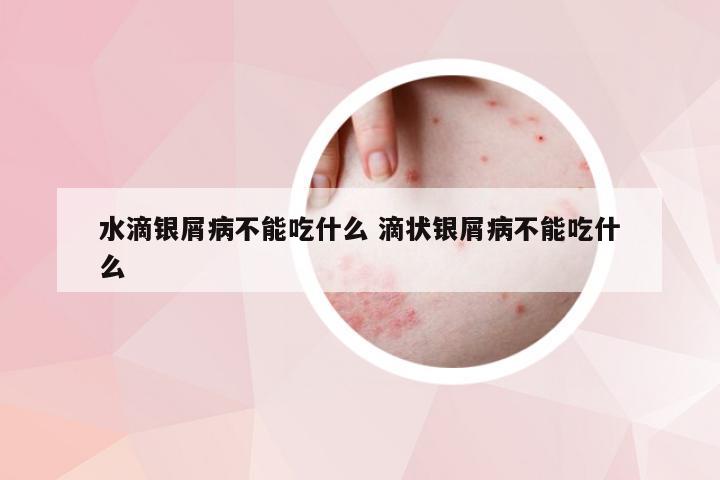 水滴银屑病不能吃什么 滴状银屑病不能吃什么