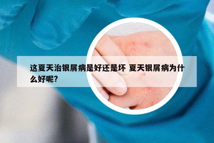 这夏天治银屑病是好还是坏 夏天银屑病为什么好呢?