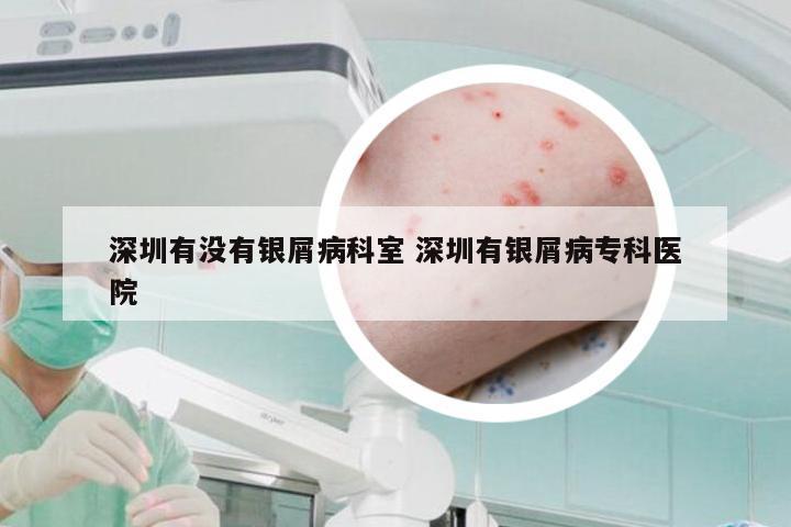 深圳有没有银屑病科室 深圳有银屑病专科医院