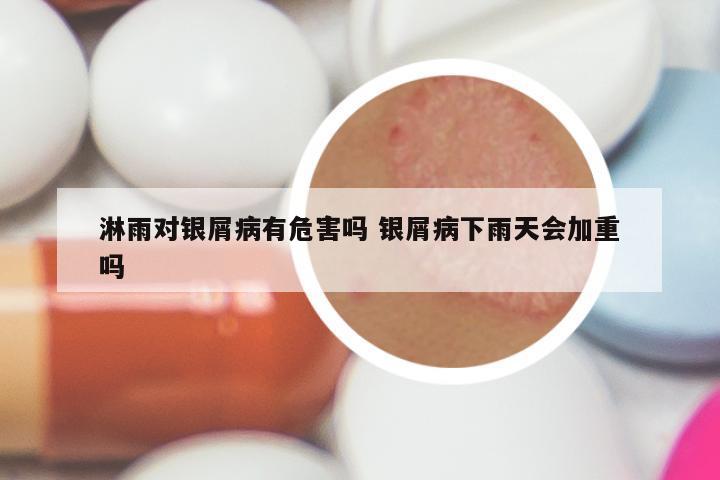 淋雨对银屑病有危害吗 银屑病下雨天会加重吗